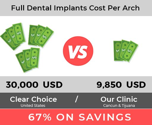 Compare Clear CHoice dental implants cost review.